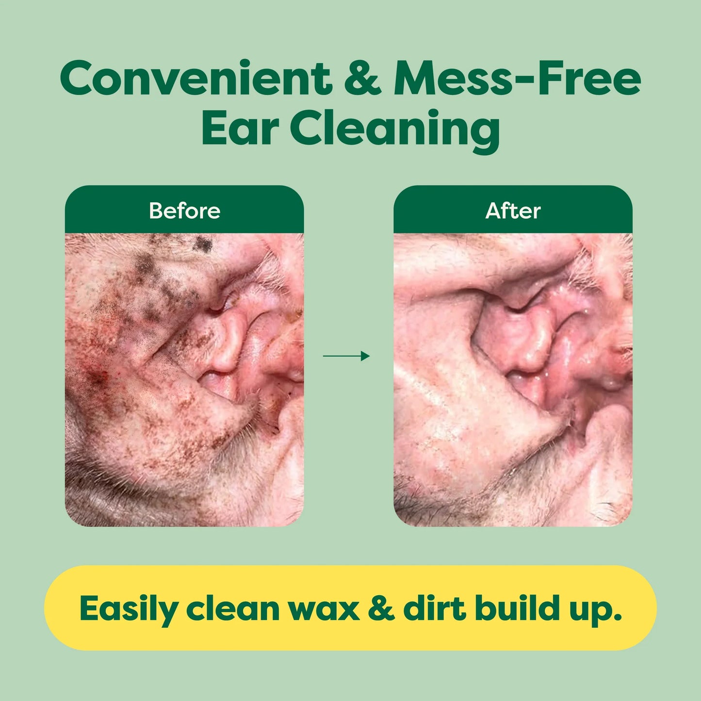 Dog Ear Wipes